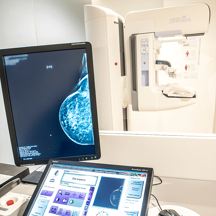 Exame de Mamografia Digital e Tomossíntese Mamária no Richet